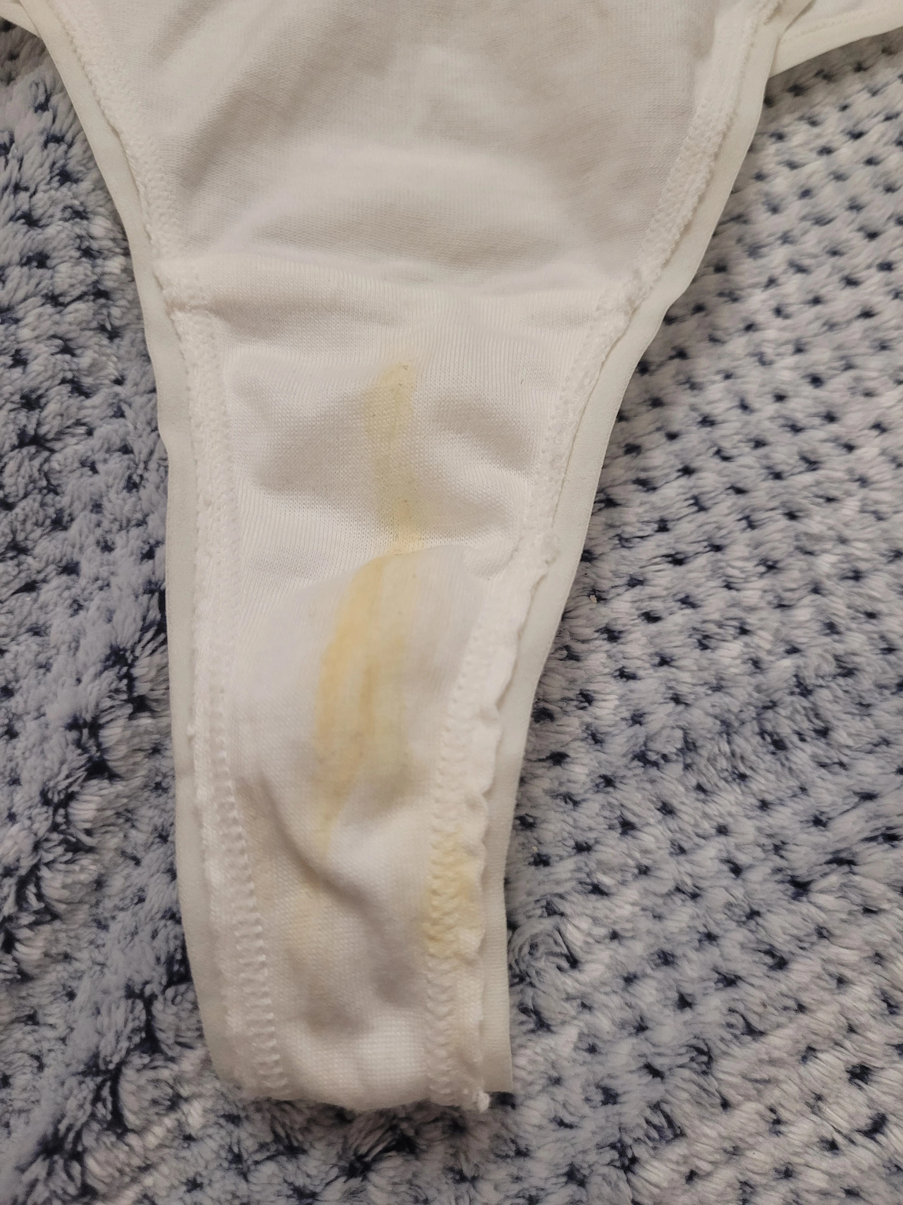 Photo de Culotte sale et jaunie du 6 décembre