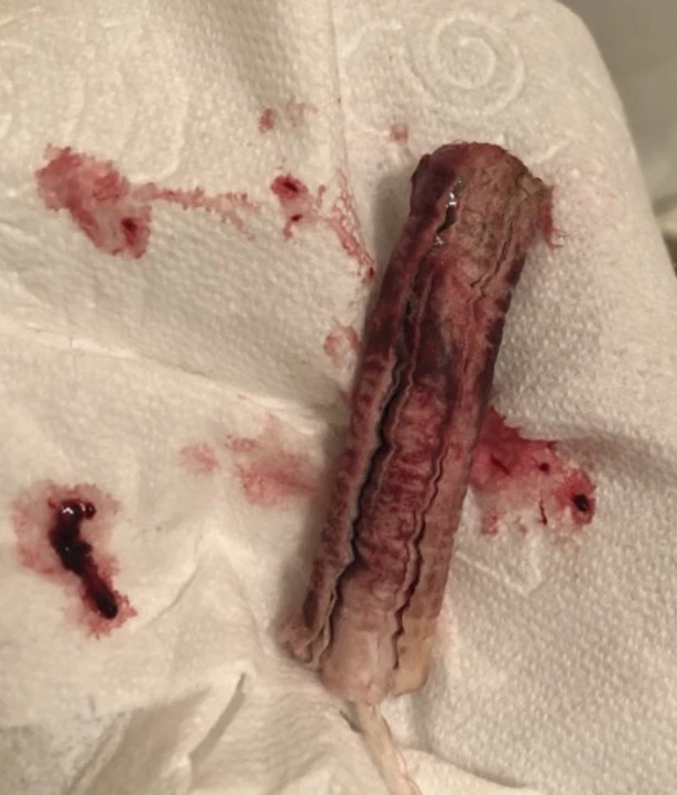 Photo de Tampon usagé